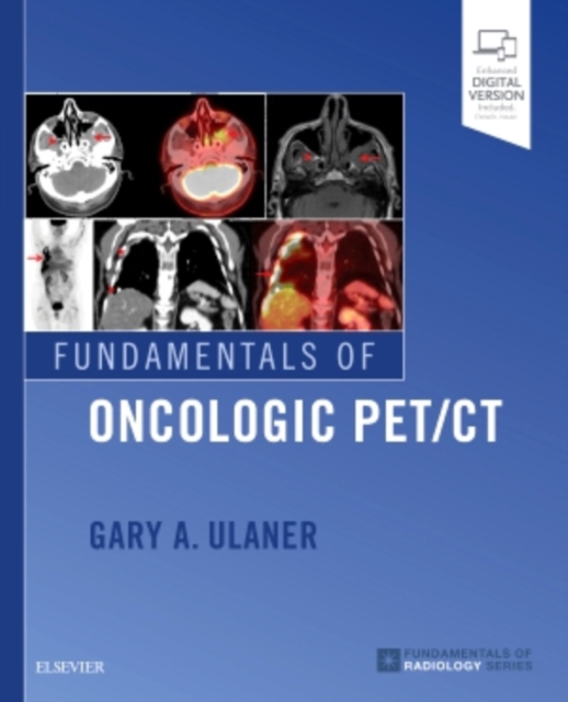 Fundamentals of Oncologic PET/CT, Paperback / softback Book