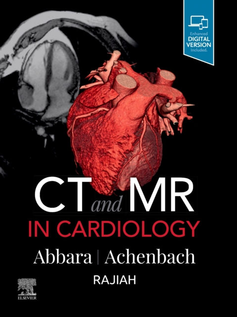CT and MR in Cardiology, Hardback Book