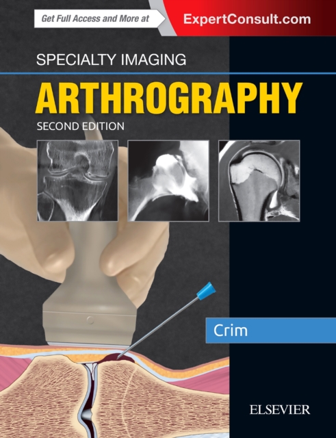 Specialty Imaging: Arthrography, Hardback Book