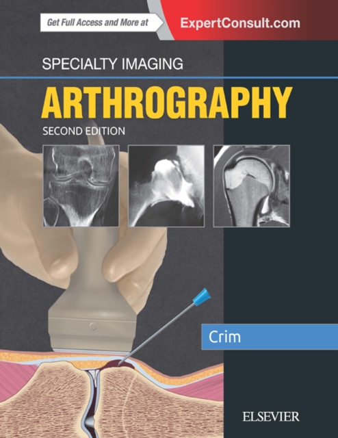 Specialty Imaging: Arthrography E-Book : Specialty Imaging: Arthrography E-Book, EPUB eBook