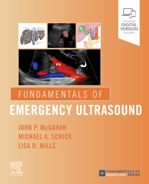 Fundamentals of Emergency Ultrasound, Paperback / softback Book