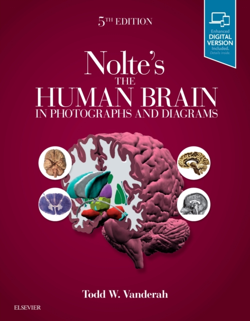 Nolte's The Human Brain in Photographs and Diagrams, Paperback / softback Book