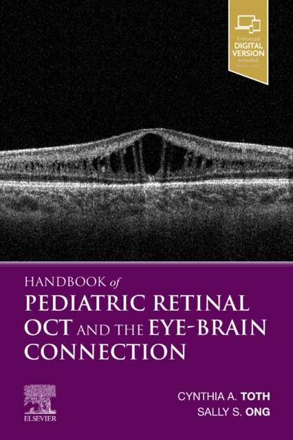 Handbook of Pediatric Retinal OCT and the Eye-Brain Connection, Paperback / softback Book