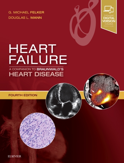 Heart Failure: A Companion to Braunwald's Heart Disease, Hardback Book
