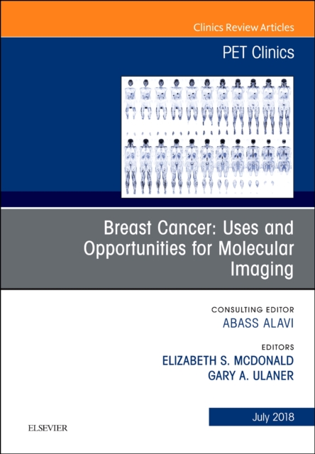 Breast Cancer: Uses and Opportunities for Molecular Imaging, An Issue of PET Clinics : Volume 13-3, Hardback Book