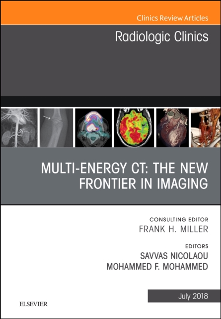 Multi-Energy CT: The New Frontier in Imaging, An Issue of Radiologic Clinics of North America : Volume 56-4, Hardback Book
