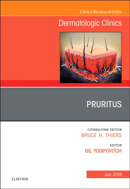 Pruritus, An Issue of Dermatologic Clinics : Volume 36-3, Hardback Book