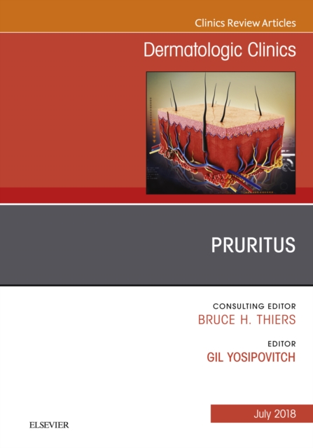 Pruritus, An Issue of Dermatologic Clinics, EPUB eBook