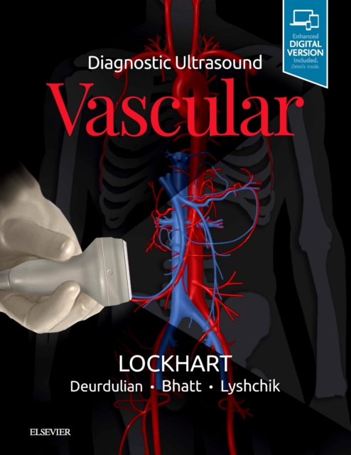 Diagnostic Ultrasound: Vascular, Hardback Book
