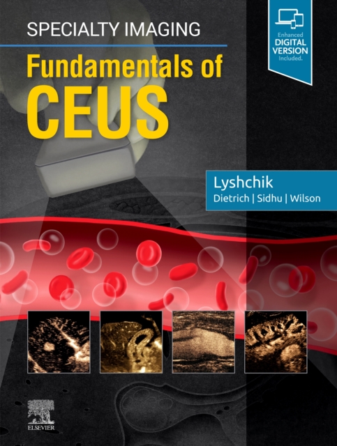 Specialty Imaging: Fundamentals of CEUS, Hardback Book