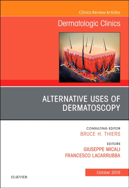 Alternative Uses of Dermatoscopy, An Issue of Dermatologic Clinics : Volume 36-4, Hardback Book