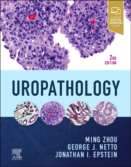 Uropathology, Hardback Book