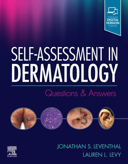 Self-Assessment in Dermatology : Questions and Answers, Paperback / softback Book