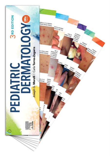 Pediatric Dermatology DDX Deck, Paperback / softback Book