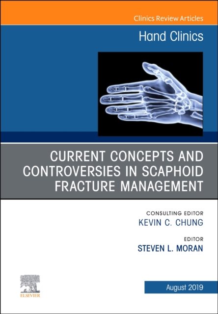 Current Concepts and Controversies in Scaphoid Fracture Management, An Issue of Hand Clinics : Volume 35-3, Hardback Book