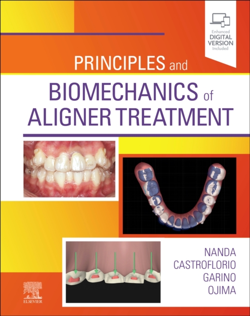 Principles and Biomechanics of Aligner Treatment, Hardback Book