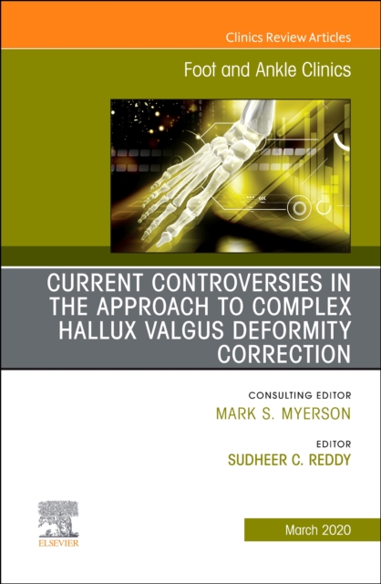 Controversies in the Approach to Complex Hallux Valgus Deformity Correction, An issue of Foot and Ankle Clinics of North America : Volume 25-1, Hardback Book