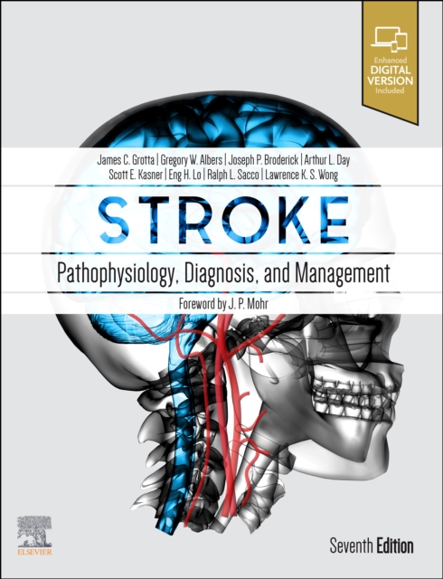 Stroke E-Book : Pathophysiology, Diagnosis, and Management, PDF eBook