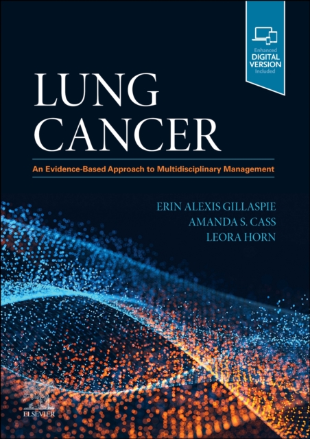 Lung Cancer : An Evidence-Based Approach to Multidisciplinary Management, Hardback Book