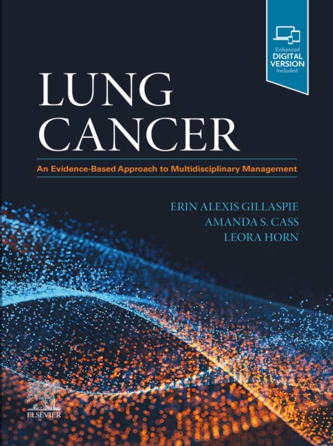 Lung Cancer E-Book : An Evidence-Based Approach to Multidisciplinary Management, EPUB eBook