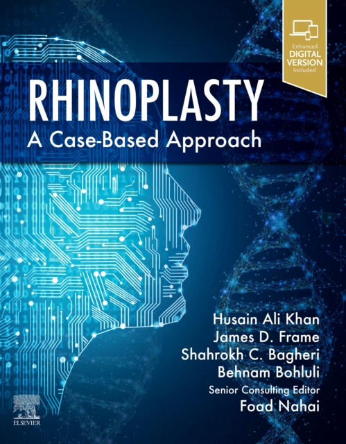 Rhinoplasty E-Book : a Case-based approach, PDF eBook