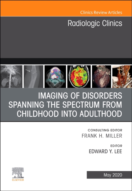 Imaging of Disorders Spanning the Spectrum from Childhood ,An Issue of Radiologic Clinics of North America : Volume 58-3, Hardback Book