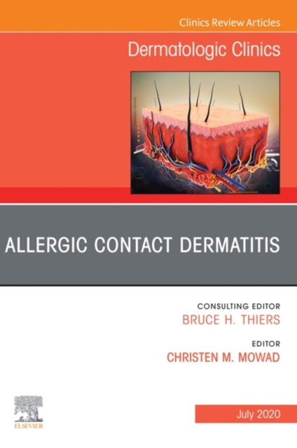 Allergic Contact Dermatitis,An Issue of Dermatologic Clinics - E-Book : Allergic Contact Dermatitis,An Issue of Dermatologic Clinics - E-Book, EPUB eBook