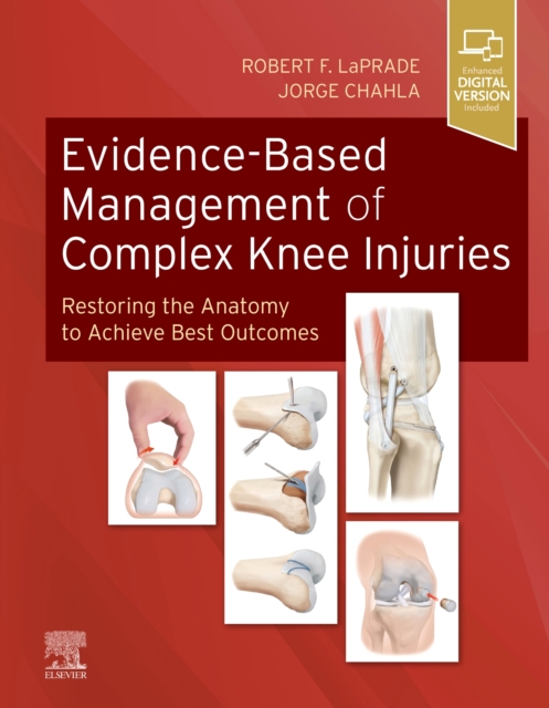 Evidence-Based Management of Complex Knee Injuries : Restoring the Anatomy to Achieve Best Outcomes, Hardback Book