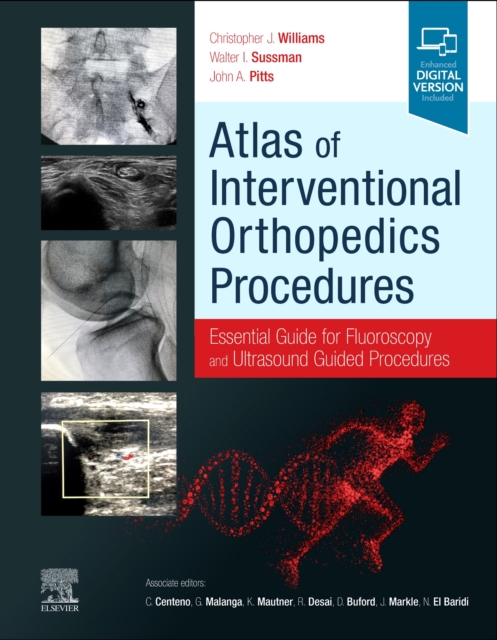 Atlas of Interventional Orthopedics Procedures : Essential Guide for Fluoroscopy and Ultrasound Guided Procedures, Hardback Book