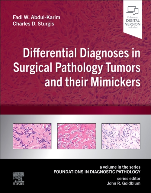 Differential Diagnoses in Surgical Pathology Tumors and their Mimickers : A Volume in the Foundations in Diagnostic Pathology series, Hardback Book