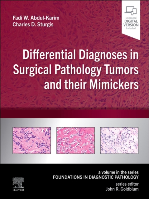 Differential Diagnoses in Surgical Pathology Tumors and their Mimickers E-Book : A Volume in the Foundations in Diagnostic Pathology series, EPUB eBook