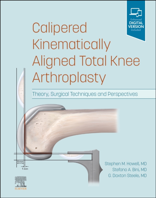 Calipered Kinematically aligned Total Knee Arthroplasty E-Book : Theory, Surgical Techniques and Perspectives, EPUB eBook