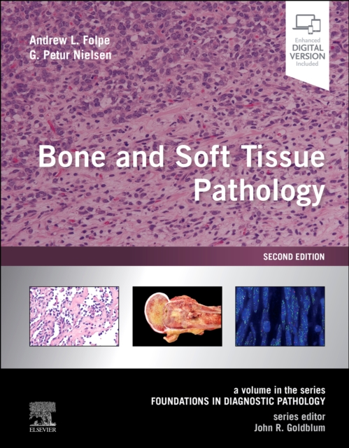 Bone and Soft Tissue Pathology E-Book : A Volume in the Foundations in Diagnostic Pathology Series, PDF eBook