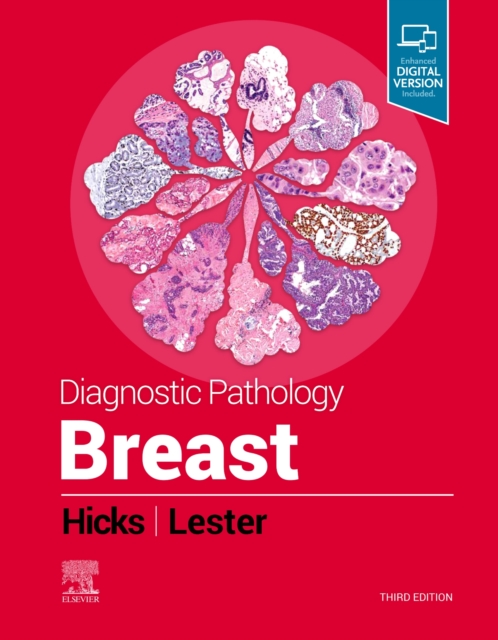 Diagnostic Pathology: Breast, Hardback Book