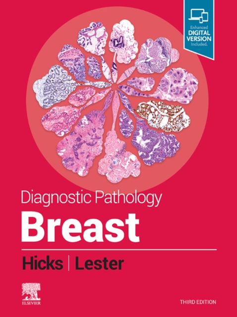Diagnostic Pathology: Breast, E-Book : Diagnostic Pathology: Breast, E-Book, EPUB eBook