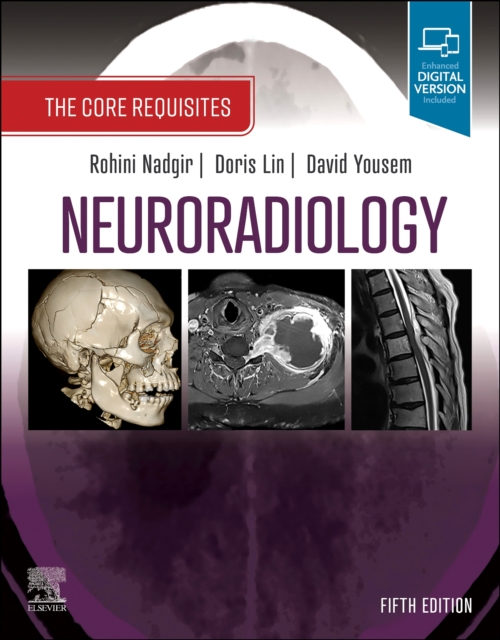 Neuroradiology : The Core Requisites, Paperback / softback Book