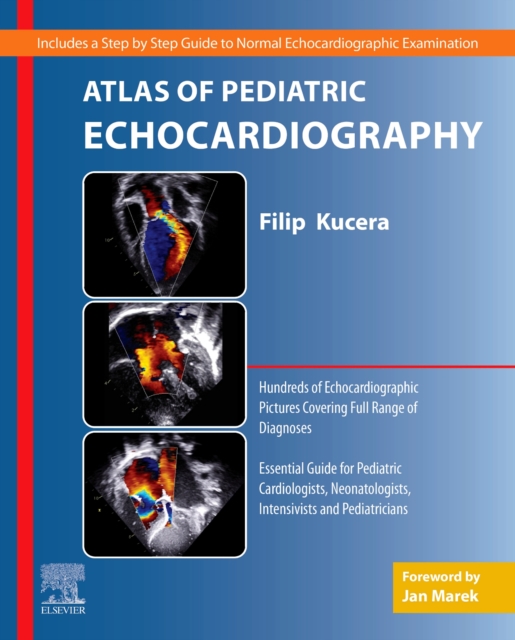 Atlas of Pediatric Echocardiography, Paperback / softback Book
