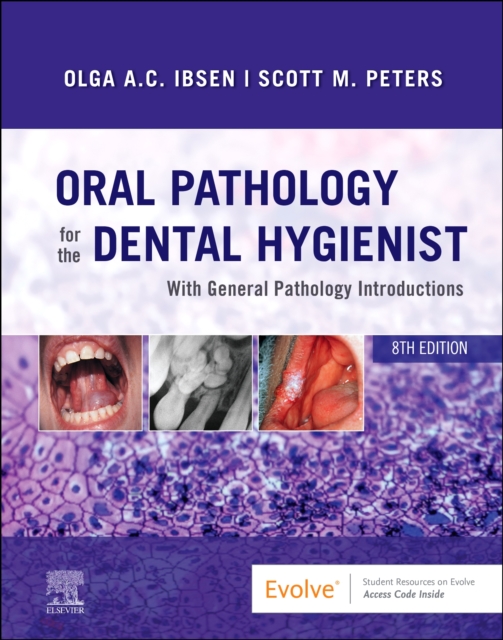 Oral Pathology for the Dental Hygienist, Hardback Book