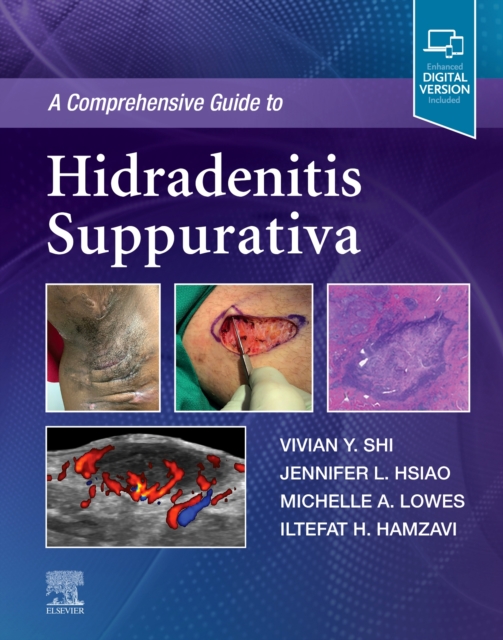 A Comprehensive Guide to Hidradenitis Suppurativa, Hardback Book
