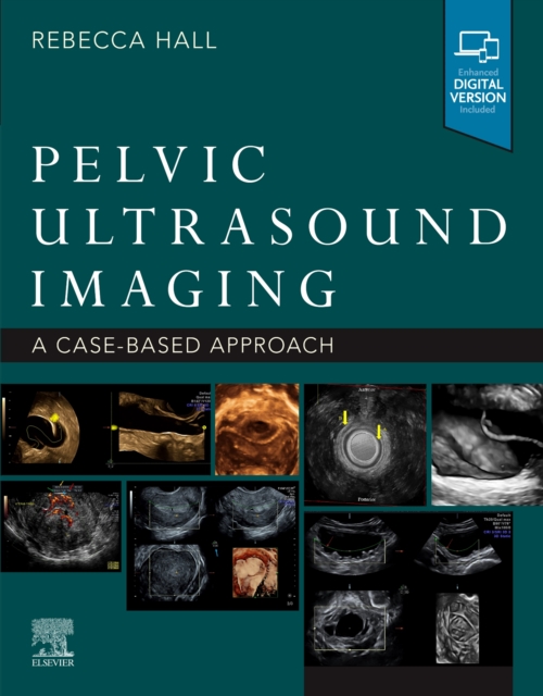 Pelvic Ultrasound Imaging : A Cased-Based Approach, Paperback / softback Book