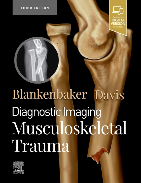 Diagnostic Imaging: Musculoskeletal Trauma, Hardback Book