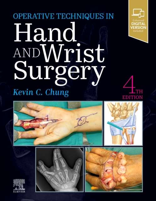 Operative Techniques: Hand and Wrist Surgery, Hardback Book