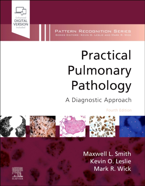 Practical Pulmonary Pathology : A Diagnostic Approach, Hardback Book