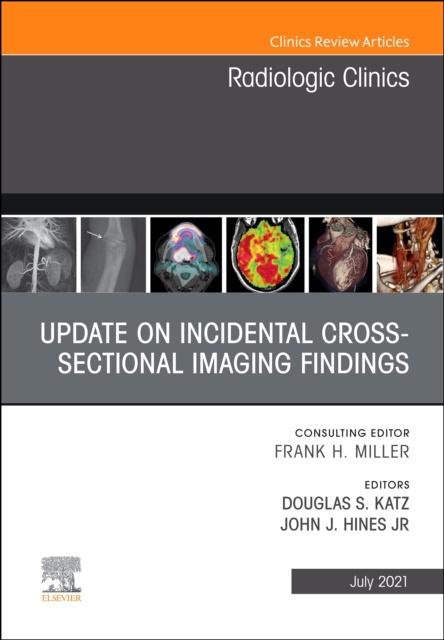 Update on Incidental Cross-sectional Imaging Findings, An Issue of Radiologic Clinics of North America, EBook : Update on Incidental Cross-sectional Imaging Findings, An Issue of Radiologic Clinics of, PDF eBook
