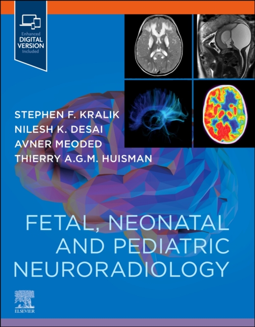 Fetal, Neonatal and Pediatric Neuroradiology, Paperback / softback Book