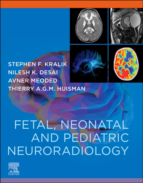 Fetal, Neonatal and Pediatric Neuroradiology - E-Book, EPUB eBook