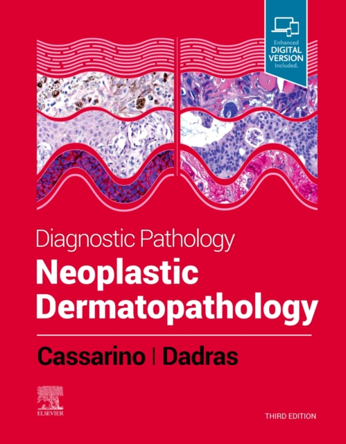 Diagnostic Pathology: Neoplastic Dermatopathology, Hardback Book