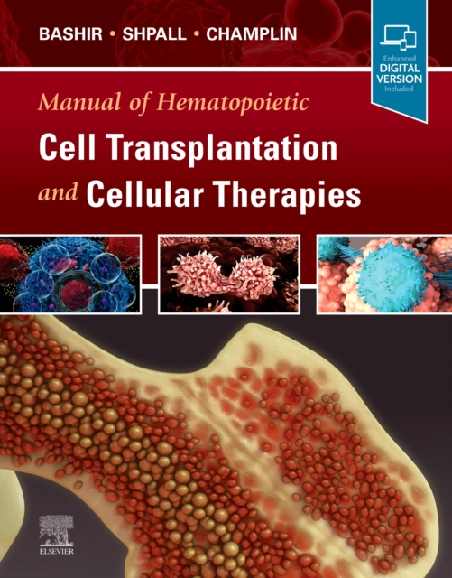 Manual of Hematopoietic Cell Transplantation and Cellular Therapies, Hardback Book
