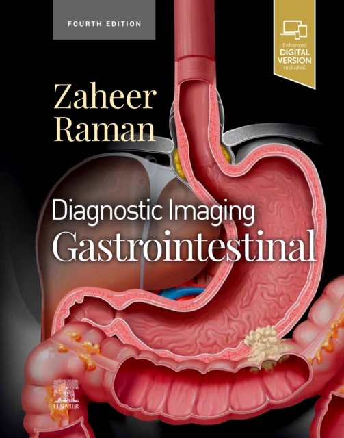 Diagnostic Imaging: Gastrointestinal, Hardback Book
