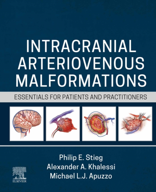 Intracranial Arteriovenous Malformations : Essentials for Patients and Practitioners, EPUB eBook